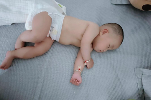 东方六个月宝宝眼睛散光